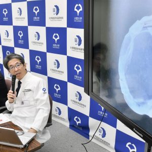 Japan Osaka University Team Does World’s First Successful iPS Cell-Derived Corneal Transplant 001