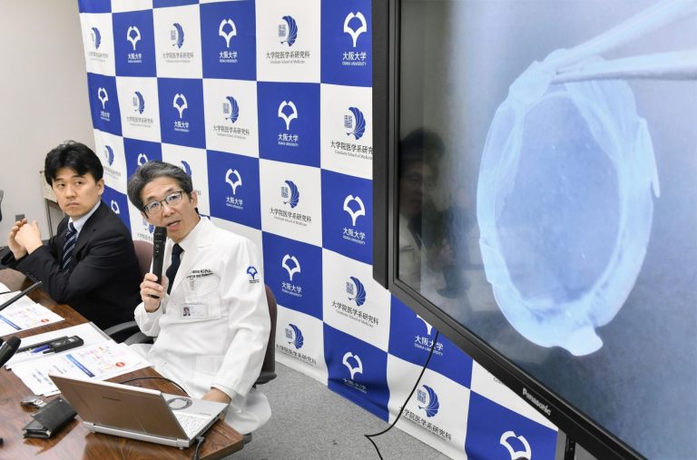 Japan Osaka University Team Does World’s First Successful iPS Cell-Derived Corneal Transplant 001