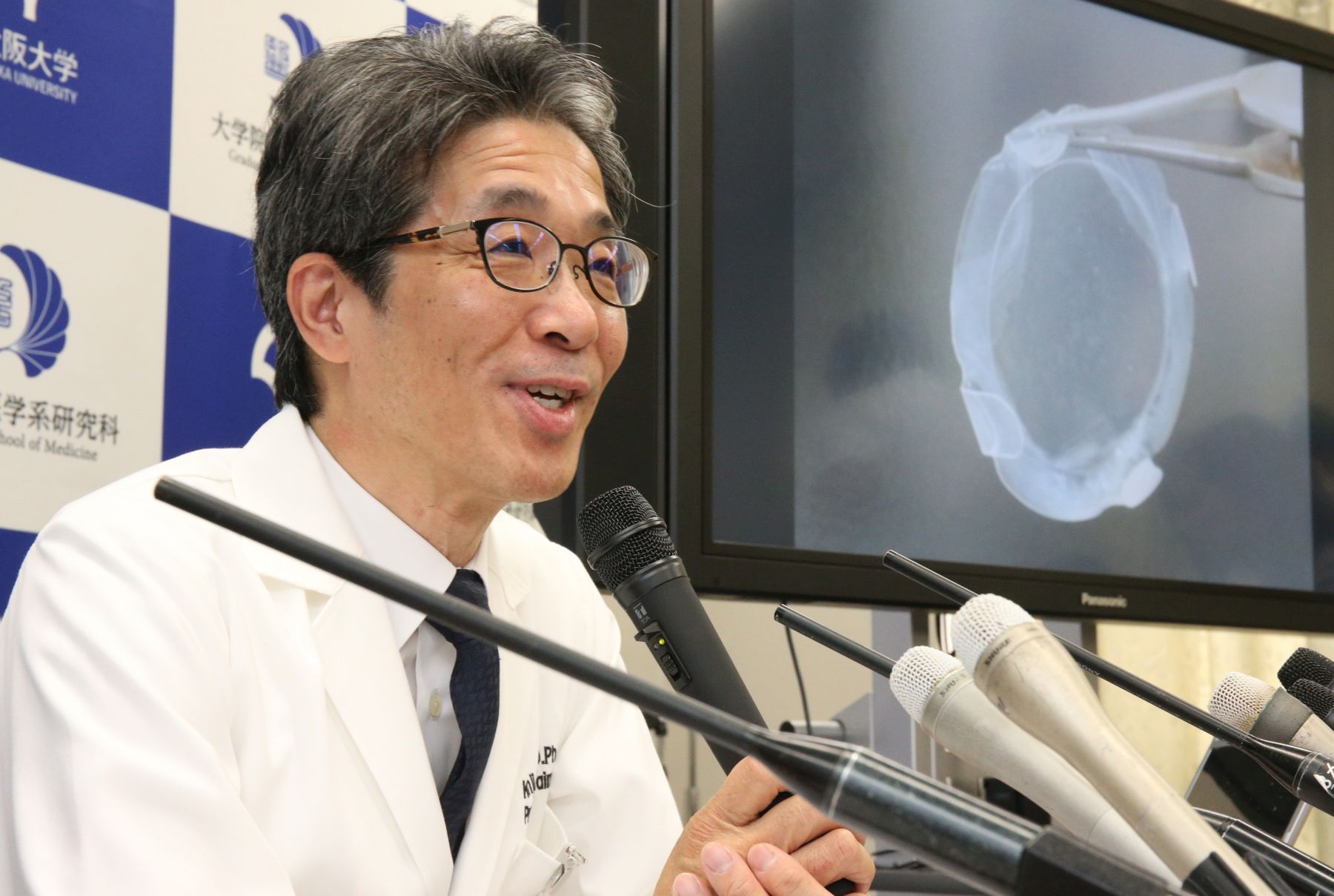 Japan Osaka University Team Does World’s First Successful iPS Cell-Derived Corneal Transplant