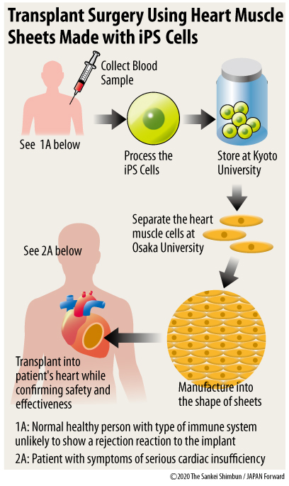 INTERVIEW | iPS Cell Research with Shinya Yamanaka and Jun Takahashi ...