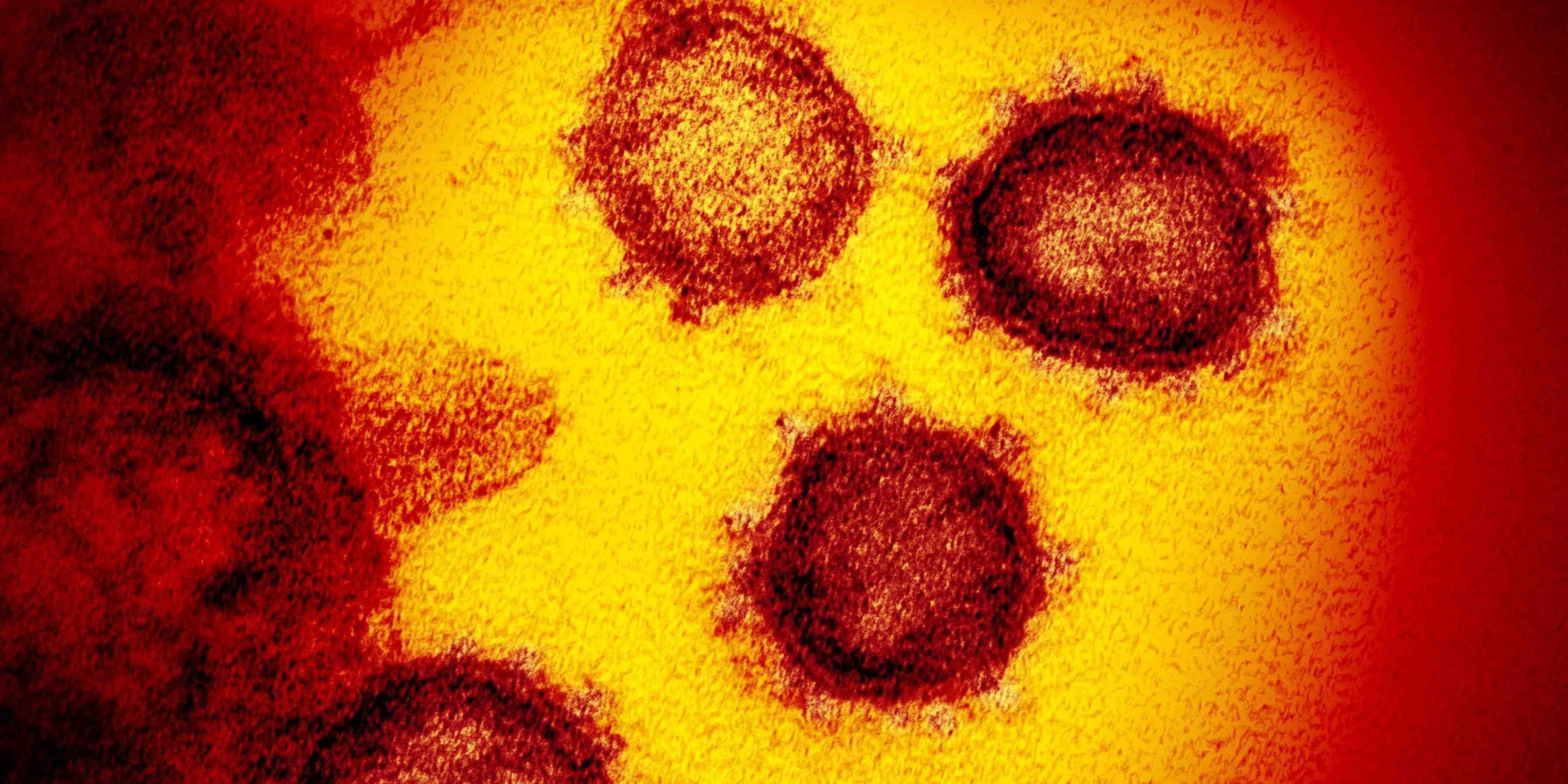 Pandemic Coronavirus 011