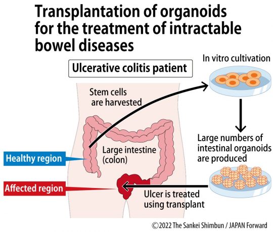 Tokyo Medical And Dental University Team Succeeds With First Mini Organ 